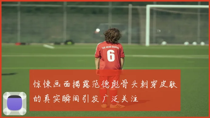 惊悚画面揭露范德彪骨头刺穿皮肤的真实瞬间引发广泛关注